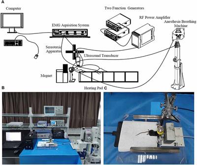 Comparative Study of Transcranial Magneto-Acoustic Stimulation and Transcranial Ultrasound Stimulation of Motor Cortex